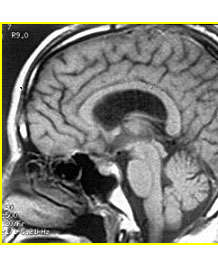 �򽨿�����Փ�ģ����Y��(ji��)�XĤ�������g��·�ͼ���