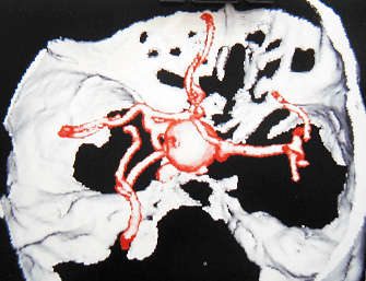 �򽨿�����Փ�ģ��B�Ⱦ޴���}�����@΢������g�ί�